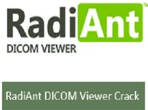 RadiAnt DICOM Viewer 2023.2 Crack + License Key Download